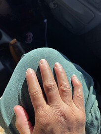 The puffy, red fingers was key something is wrong